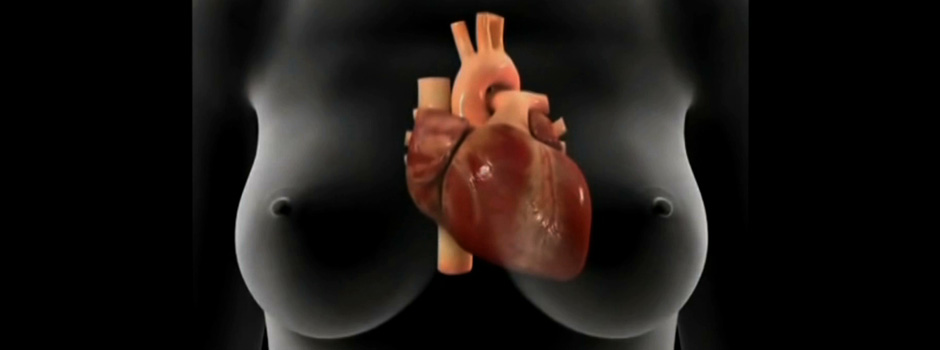 Corazon