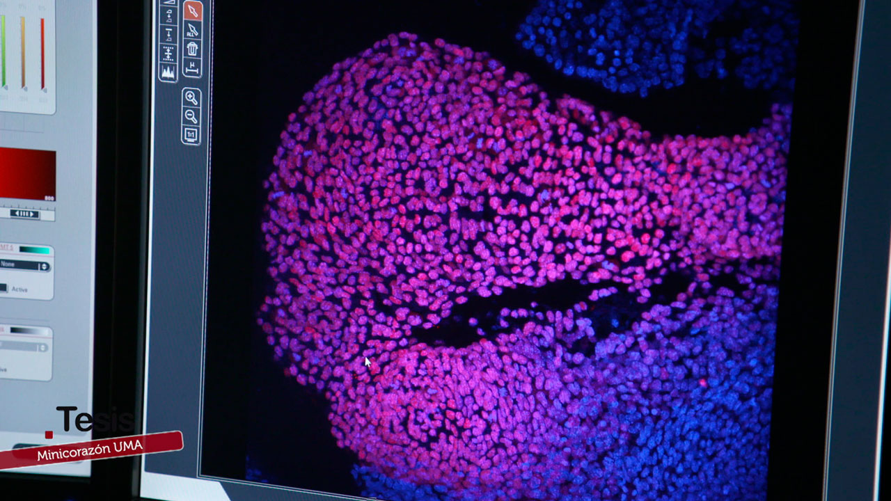 Minicorazón humano de células madre