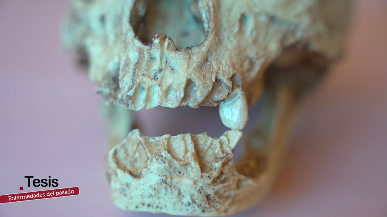 Enfermedades del pasado, estudio sobre ADN antiguo y enfermedades
