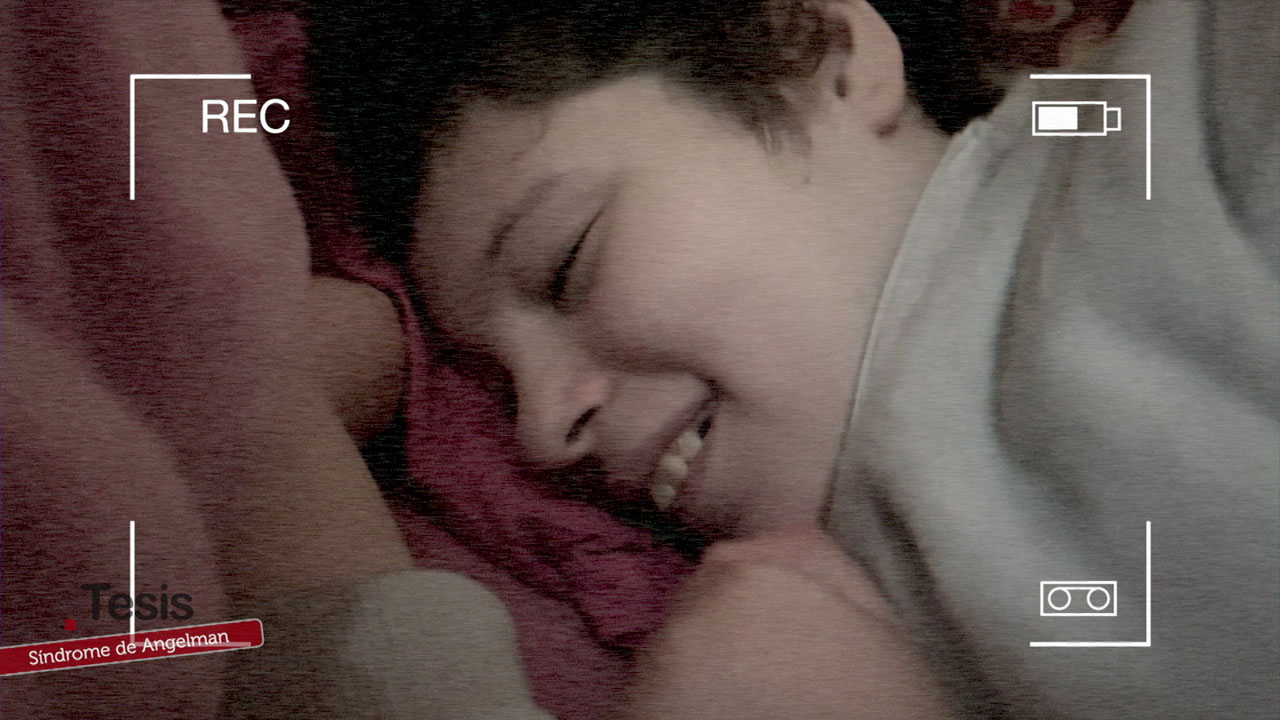 Síndrome de Angelman: causas, síntomas y realidad de una enfermedad rara genética